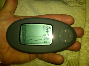 Dexcom1